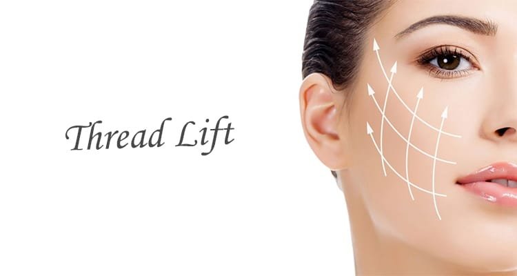 Perbedaan Thread Lift dan Tanam Benang, Apa Saja Manfaat dan Efek Sampingnya?