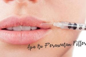 Apa Itu Filler Treatment?