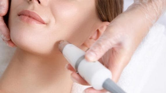 Teknik Mikrodermabrasi Treatment Anti Aging Terkini