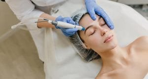 Proses Dermabrasi