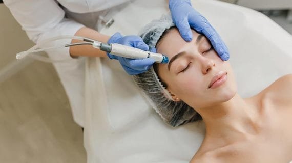 Proses Dermabrasi Wajah Agar Kulit Lebih Cantik!
