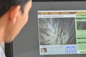 Yuk Ketahui Alasan Perlu PRP Treatment Yang Tepat!