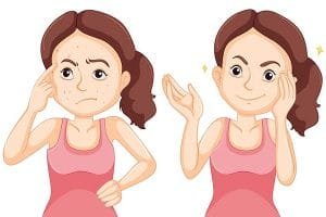 Inilah Langkah Tepat Dalam Tips Obati Jerawat Untuk Anda!