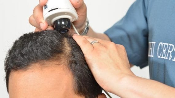 8 Fakta Rambut Yang Perlu Anda Tahu