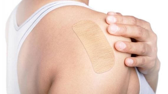 Cara Mengatasi Keloid Paling Ampuh