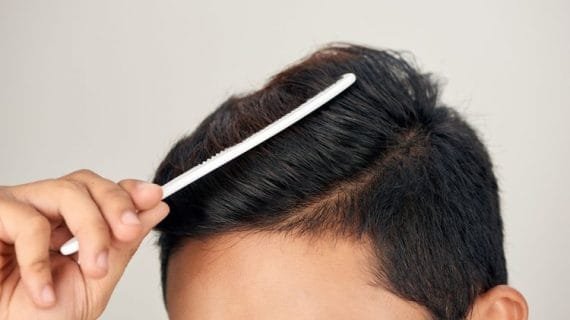 Tips Menghilangkan Rambut Berketombe dengan Cara Alami
