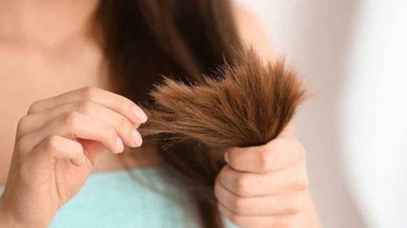 Masalah Rambut Bercabang, Penyebab dan Cara Mengatasinya