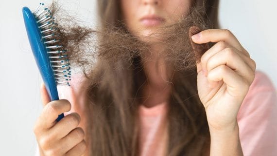 Penyebab Rambut Rontok Berlebihan, Mencegah dan Mengatasi