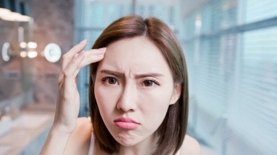 Tidak Percaya Diri Karena Wajah Kusam dan Berjerawat? Singkirkan Dengan Hal Ini!
