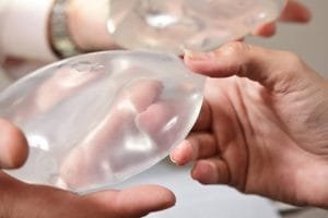 Alasan Operasi Plastik Implan Payudara Seorang Wanita