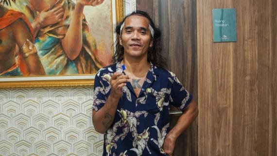 Mengalami Kebotakan, Kaka Slank Transplantasi Rambut di Farmanina Clinic