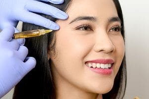 9 Manfaat PRP Treatment untuk Kesehatan dan Kecantikan Kulit