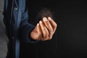 7 Penyebab Rambut Rontok Parah Pria + Solusi Medis dari dr Farmanina
