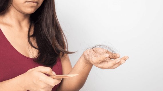Penyebab Rambut Rontok Parah pada Wanita: Dari Stres Hingga Faktor Genetik