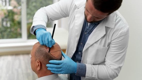 Apakah Tanam Rambut Sakit? Informasi Lengkap yang Perlu Diketahui