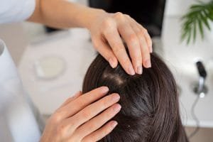 JIka Folikel Rambut Mati, Apakah Bisa Tumbuh Lagi?