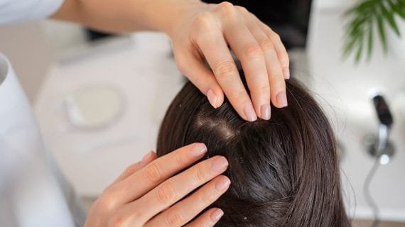 JIka Folikel Rambut Mati, Apakah Bisa Tumbuh Lagi?