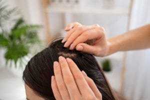 Cara Mencegah Ketombe yang Efektif dengan Tips dan Trik untuk Kulit Kepala Sehat