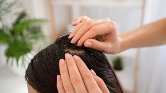 Cara Mencegah Ketombe yang Efektif dengan Tips dan Trik untuk Kulit Kepala Sehat