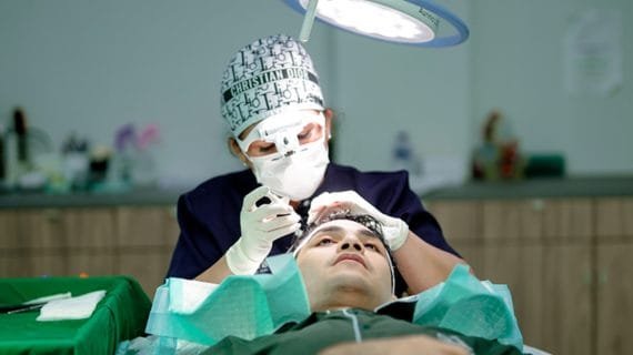 Berkenalan Dengan Metode Transplantasi Rambut dan Kelebihannya
