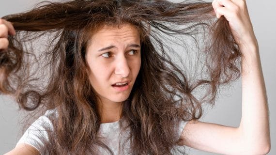 Ketahui Penyebab dan Cara Mengatasi Akar Rambut yang Lemah dan Rapuh