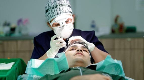 Implan Rambut: Prosedur, Metode Terbaik, dan Estimasi Biaya 2026