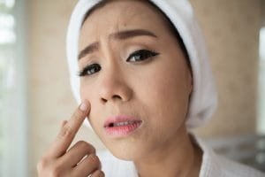 Mengenal Sel Kulit Mati di Wajah: Ciri-Ciri, Penyebab, dan Cara Mengangkatnya