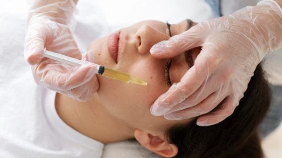 Apa Itu Acne Injection dan Cara Kerjanya untuk Atasi Jerawat
