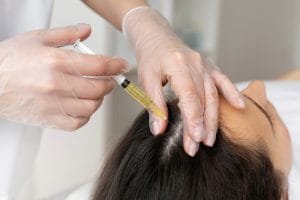 Berapa Lama Hasil PRP Rambut Terlihat? Panduan Lengkap untuk Hasil Maksimal