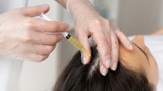 Berapa Lama Hasil PRP Rambut Terlihat? Panduan Lengkap untuk Hasil Maksimal