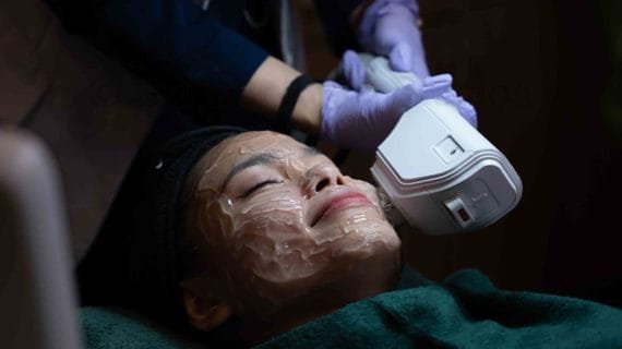 Manfaat Laser Wajah untuk Perawatan Kulit