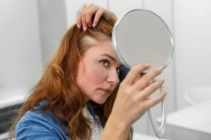 Perawatan Garis Rambut Mundur untuk Wanita dengan Aman