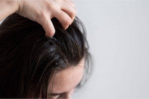 Solusi Rambut Berminyak & Ketombe Parah? Ini Rutinitas Perawatan yang Wajib Dicoba