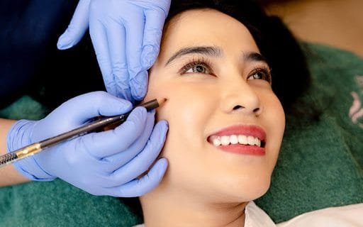 Ingin Wajah Kencang Tanpa Operasi? Tarik Benang Bisa Jadi Solusinya