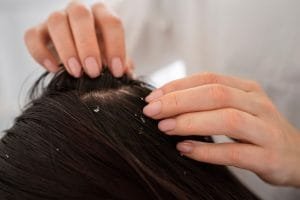 Hair Treatment Apa Saja yang Ada di Farmanina Hair & Aesthetic Clinic? Intip 7 Treatment-nya!