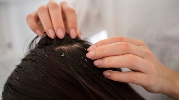 Hair Treatment Apa Saja yang Ada di Farmanina Hair & Aesthetic Clinic? Intip 7 Treatment-nya!