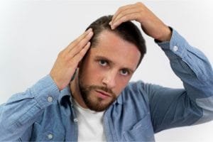 Ini Penyebab Rambut Rontok pada Pria di Usia Muda dan Solusinya