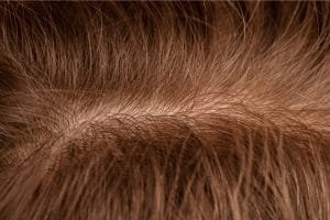 Kenapa Pertumbuhan Rambut Lambat? Ini Fase, Penyebab, Dan Cara Mengatasinya