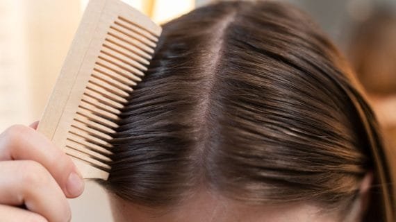 Mengapa Rambut Jarang-jarang? Ternyata Ini Penyebabnya
