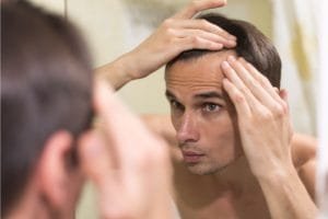 Transplantasi Rambut Gagal? Ini Penyebab dan Pantangan yang Harus Diperhatikan