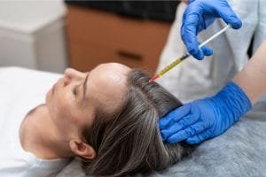 Kapan Hasil Hair PRP Mulai Terlihat? Panduan Lengkap untuk Rambut Lebih Sehat