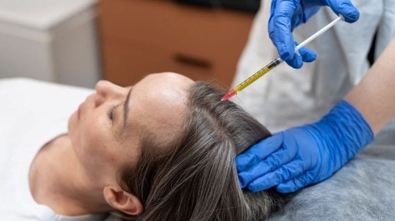 Kapan Hasil Hair PRP Mulai Terlihat? Panduan Lengkap untuk Rambut Lebih Sehat