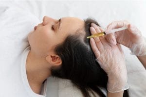7 Pantangan Setelah PRP Rambut agar Hasil Perawatan Maksimal