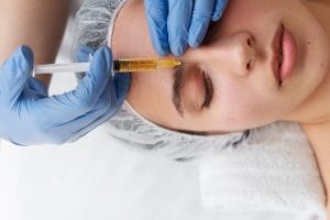 Platelet Rich Plasma adalah Perawatan Kulit Modern untuk Hasil Maksimal