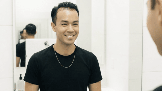 Unshaven FUE: Transplantasi Rambut Tanpa Mengubah Penampilan